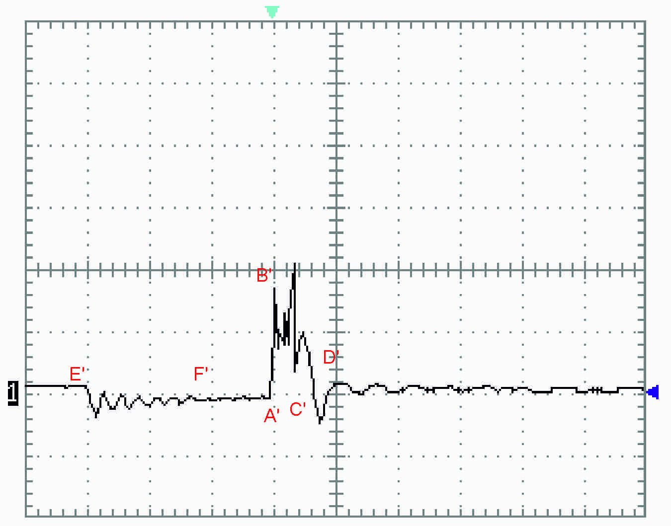 Oscilloscope pattern 2: large gap between the ignition lead terminal and the spark plug terminal, with two discharges between B' and C'