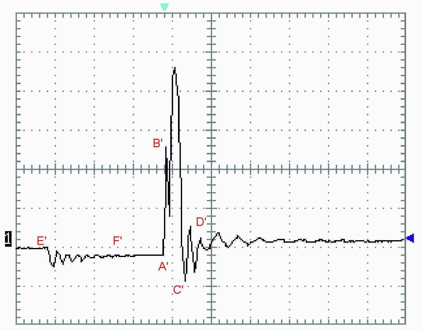 Oscilloscope pattern 1: small gap between the ignition lead terminal and the spark plug terminal, with a series of small discharges between B' and C'